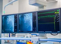 Echocardiography Identifies Mortality Risk in Critically Ill Patients With Pulmonary Hypertension