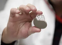 Do Pacemakers Influence Outcomes in Atrial Fibrillation?