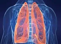 Impaired Lung Function Increases Arterial Peripheral Vascular Disease Risk in Type 2 Diabetes