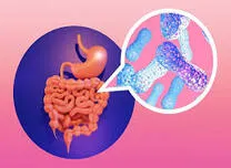  Gut Microbiota Dysbiosis Drives Metabolic Dysfunction in Early-Onset Type 2 Diabetes