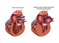 	CMR-Derived Risk Score Enhances Arrhythmic Event Prediction in Non-Ischemic Cardiomyopathy