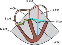 Ventricular Geometry Linked to Brain Structure and Cognitive Function