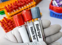 Balanced Folate and Vitamin B12 Intake Linked to Gestational Diabetes Risk
