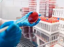 Can Earlier Evaluation Reduce Major Cardiovascular Events in BAV Infective Endocarditis?