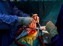 Timely Repeat Ablation Enhances Rhythm Control in Recurrent Atrial Fibrillation