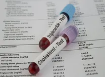 Can Digital Guidance Accelerate Lipid Therapy Intensification After ACS? Trial Shows Early Trends