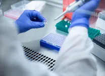 Serum Iron Independently Predicts One-Year MACCE Risk in Diabetic CAD