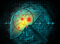 Fibrosis Severity Strongly Impacts Microvascular Risk in Type 2 Diabetes