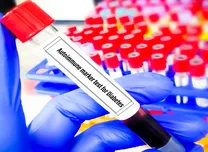 GADA Screening Identifies Distinct Autoimmune Subtype in Early-Onset Diabetes 
