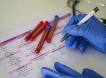 Glycemic Markers Predict Mortality Differently After Critical Ischemic Stroke