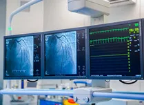 Cardioversion After LAA Occlusion Demonstrates Strong Safety Profile