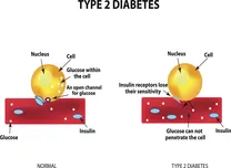Cycling-Based HIIT Lowers Visceral Fat Within 8–12 Weeks in Type 2 Diabetes