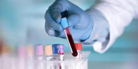 Blood Testing
