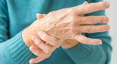 Carpal tunnel syndrome (CTS)