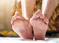 Frailty Severity Predicts Diabetic Foot Ulcer and Mortality Risk in T2DM