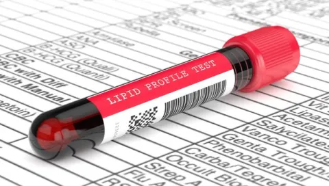 Lipid Profile Test