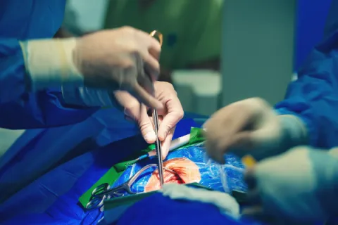 Mitral Valve Replacement