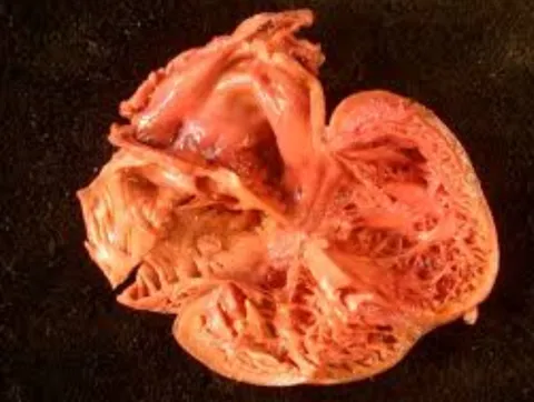 Heart