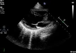 echocardiographic imaging
