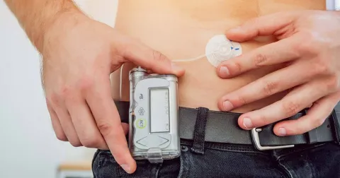 Insulin-pump-man