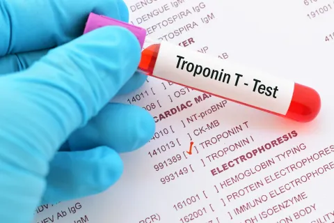 Troponin T-Testing 