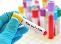 Serum Urate Levels Show a J-Shaped Association With Mortality in Diabetes