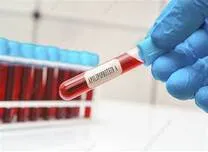 AHA 2025 Sessions: Apolipoprotein A2 Levels Predict Long-Term Mortality After Aortic Aneurysm Repair 