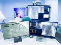 AHA 2025 Session: CTCA-Guided Angiography to detect cardiovascular events