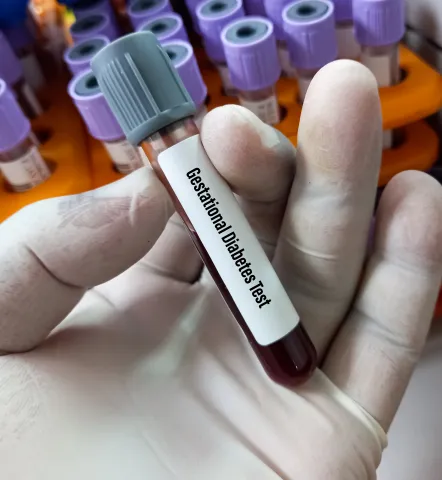 Gestational Diabetes