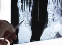 Ischemia-Modified Albumin Shows Marked Detection Value in Diabetic Foot Ulcer 