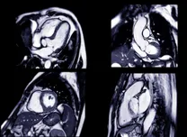 Dual-Sequence Stress CMR Shows Superior Prognostic Value Over Dual-Bolus Technique 