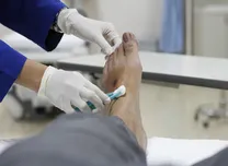 Oral Antibiotics Match Intravenous Therapy in Diabetic Foot Osteomyelitis 