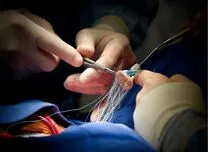 AHA 2025 Session: LVEF Below 60% Indicates Higher Risk After Aortic Valve Replacement 