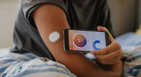 glucose monitoring