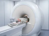 MRI-Derived VAT Improves Cardiovascular Risk Stratification Beyond PREVENT