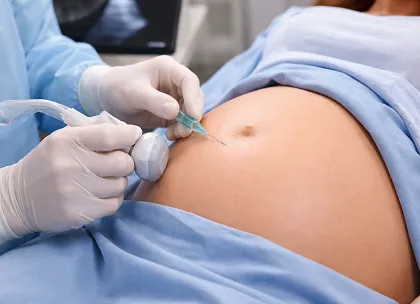 Amniocentesis for Congenital Heart Disease