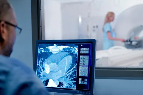 Canagliflozin Reduces Myocardial Fibrosis on CMR in T2DM