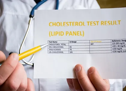 Lipid Test