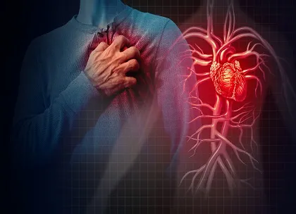 PCI in STEMI