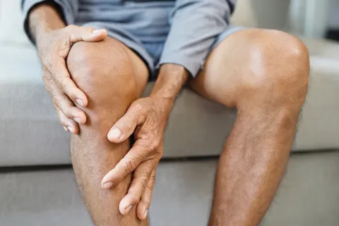 Metformin Lowers OA Incidence but Not TKR Risk in T2DM