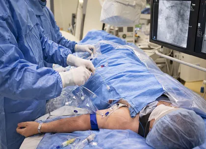 PCI in STEMI and Cardiogenic Shock