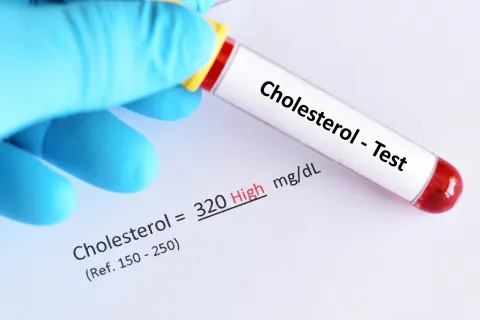 Remnant Cholesterol Stratifies Stroke Risk in Pre-DM and DM