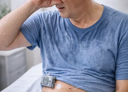 Excessive Sweating in T2D