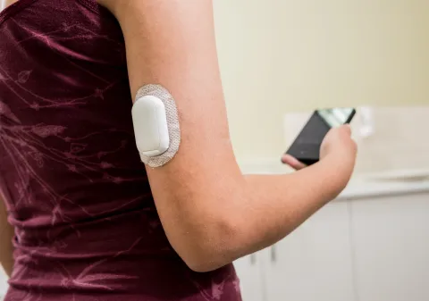 Tubeless AID Lowers HbA1c vs Injections in T1DM Trial
