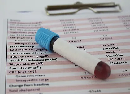 Albuminuria