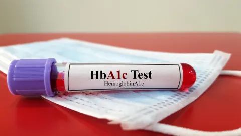 Celiac Disease Tied to Higher HbA1c in Pediatric T1DM