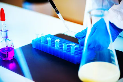 Circulating Amino Acids Associated With Type 2 Diabetes Risk