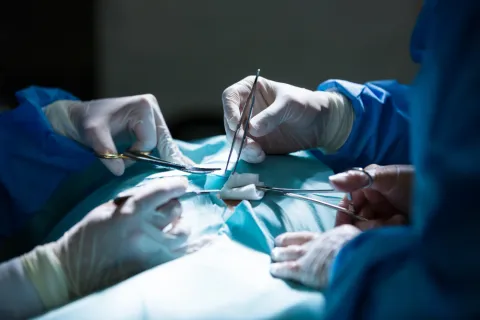 No Higher Amputation Risk Seen With SGLT2 Inhibitors in DFU 