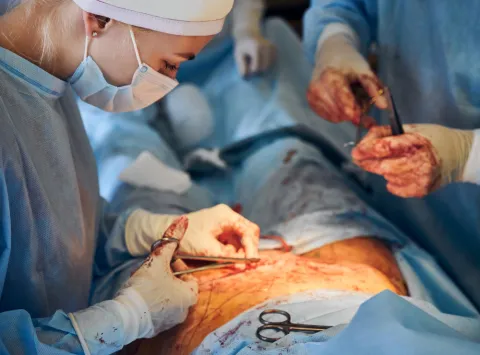 Bariatric Surgery Shows Weight Loss, Limited HbA1c Change in T1DM