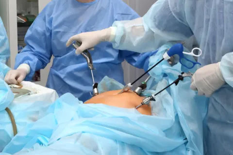 Near 30% Weight Loss Seen After Surgery in T1DM Obesity